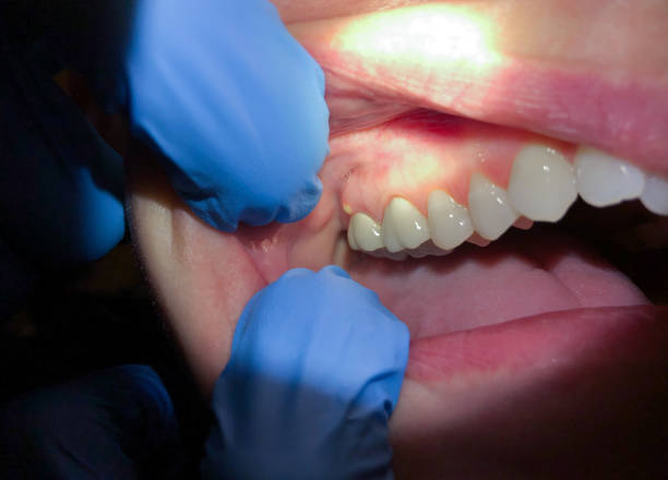 Best Emergency Dentist for Knocked-Out Tooth in East Petersburg, PA